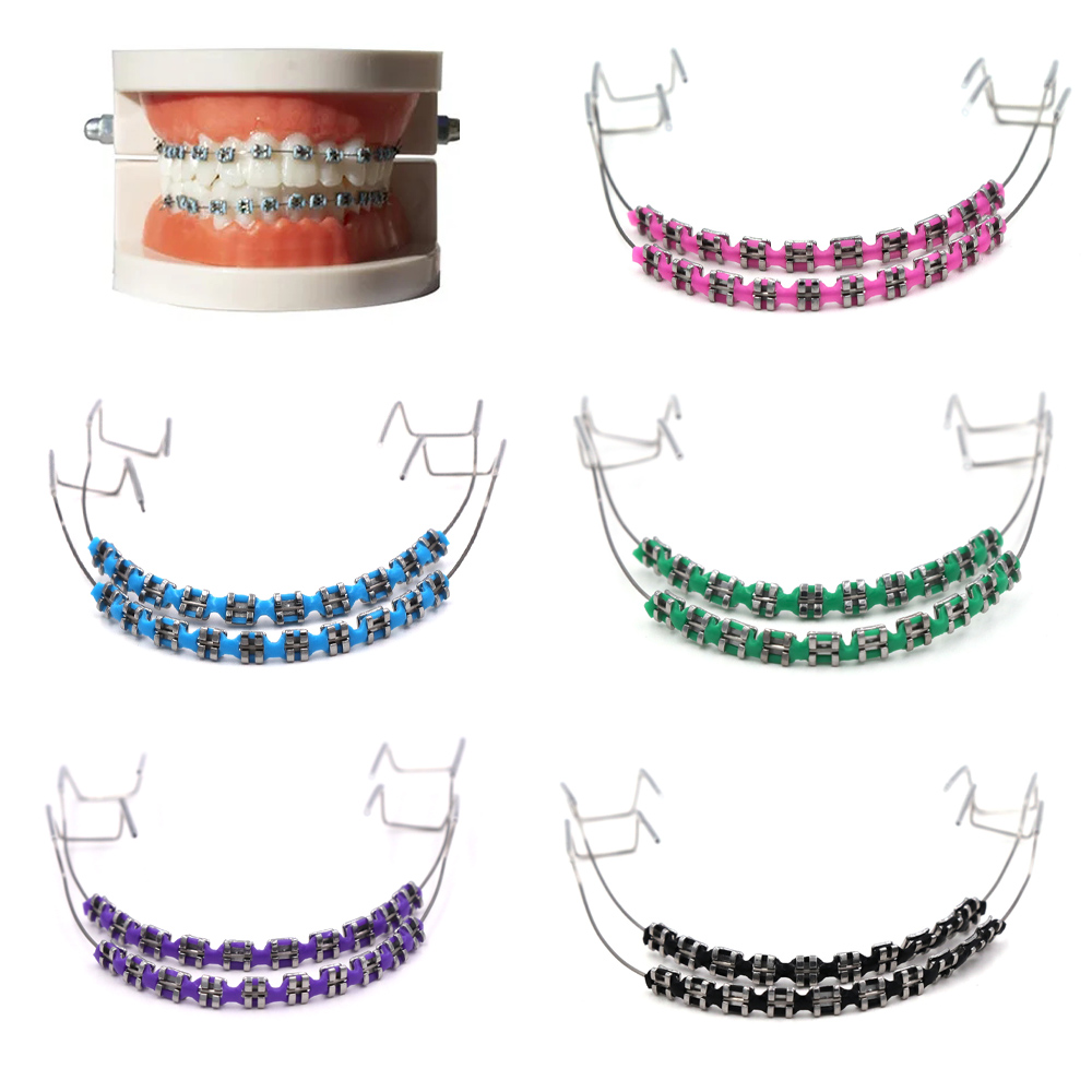 Teeth Whitening Mouth Guard - ファッションフェイクブレースキット - カラフルな矯正用リガチャータイ＆メタルブラケット | 安全で快適 |
