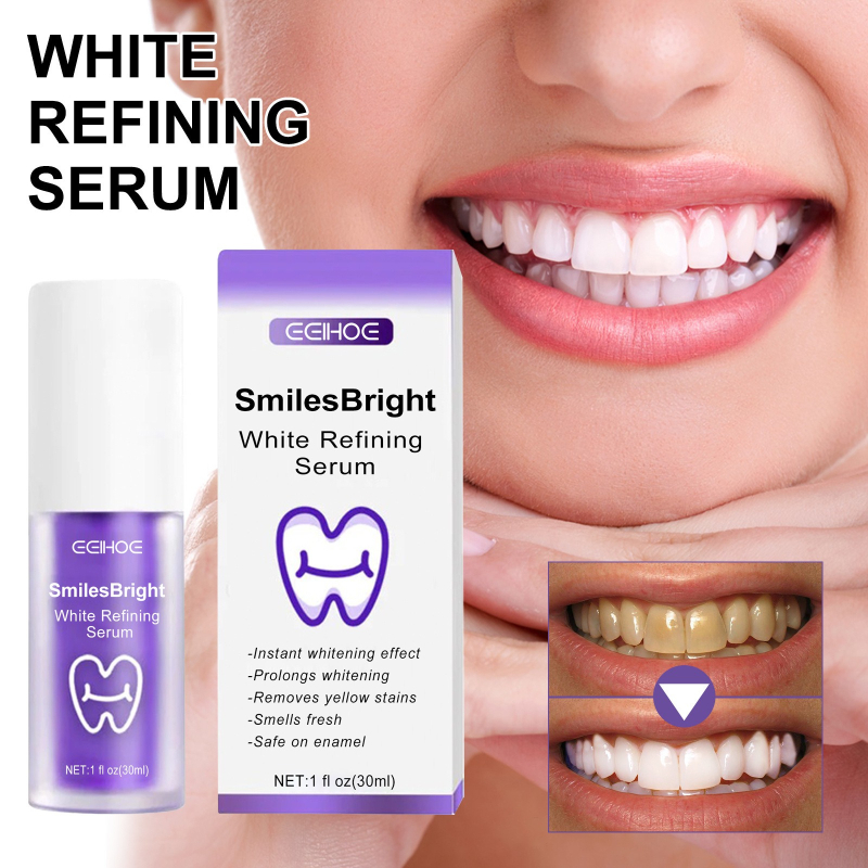 Teeth Whitening Korea - 歯のクリーニング ホワイトニング歯磨き粉 ホワイトニングジェル ホワイトナー ブリーチ 汚れを除去