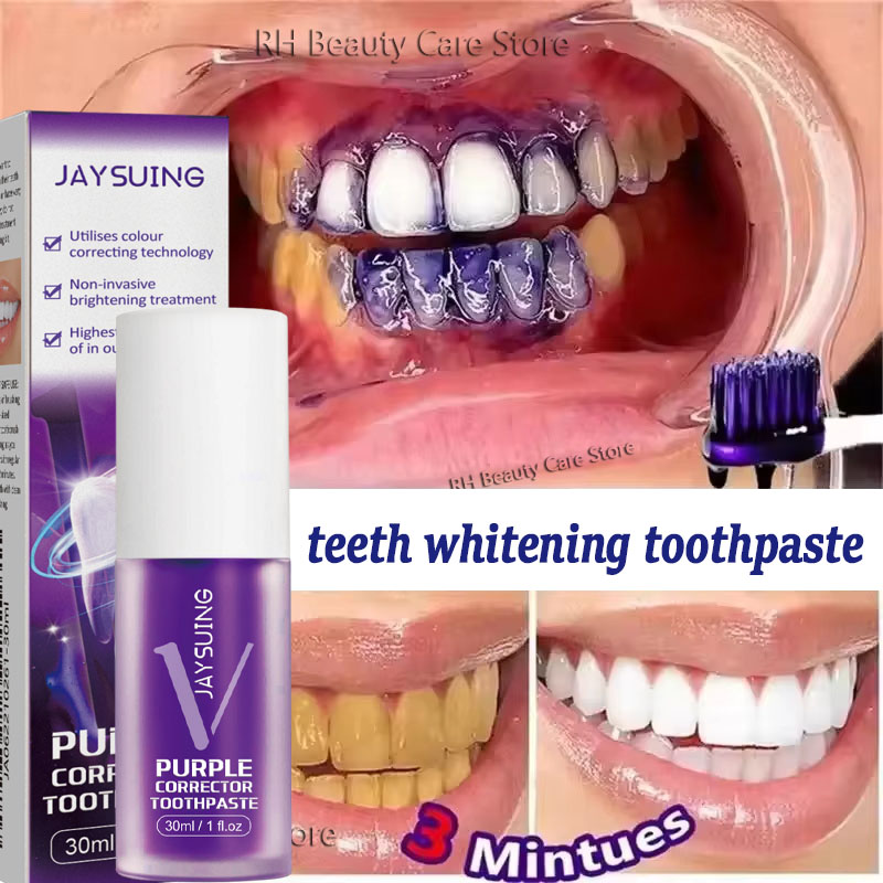 Teeth Whitening Korea - 歯のホワイトニング歯磨き粉、ホワイトニングジェル、ホワイトナー、漂白剤、汚れ除去、息の臭い除去、歯のクリーニング、韓国製品