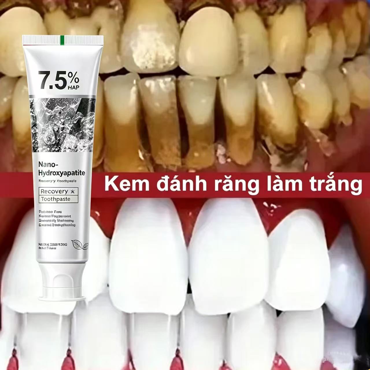 Hydroxyapatite Toothpaste - 7.5% ハイドロキシアパタイトプロバイオティクスホワイトニング歯磨き粉エナメル口腔修復口臭清涼歯ホワイトナー歯磨き粉 120 グラム