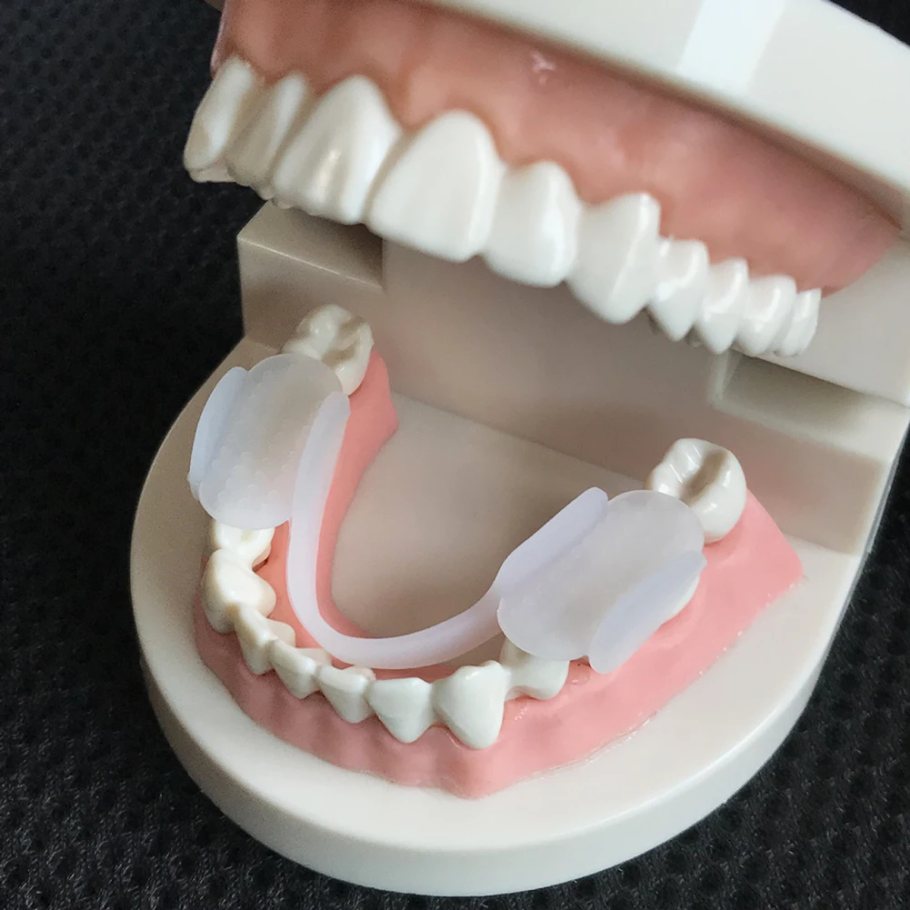 Dental Guard Night - 2 個の歯の副木プロテクターソフトナイト耐摩耗パッド耐摩耗シリコーン歯パッド夜間研削歯ぎしり用