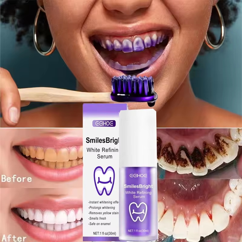 歯のホワイトニング歯磨き粉、ホワイトニングジェル、ホワイトナ - Teeth Whitening Korea のレビューと価格