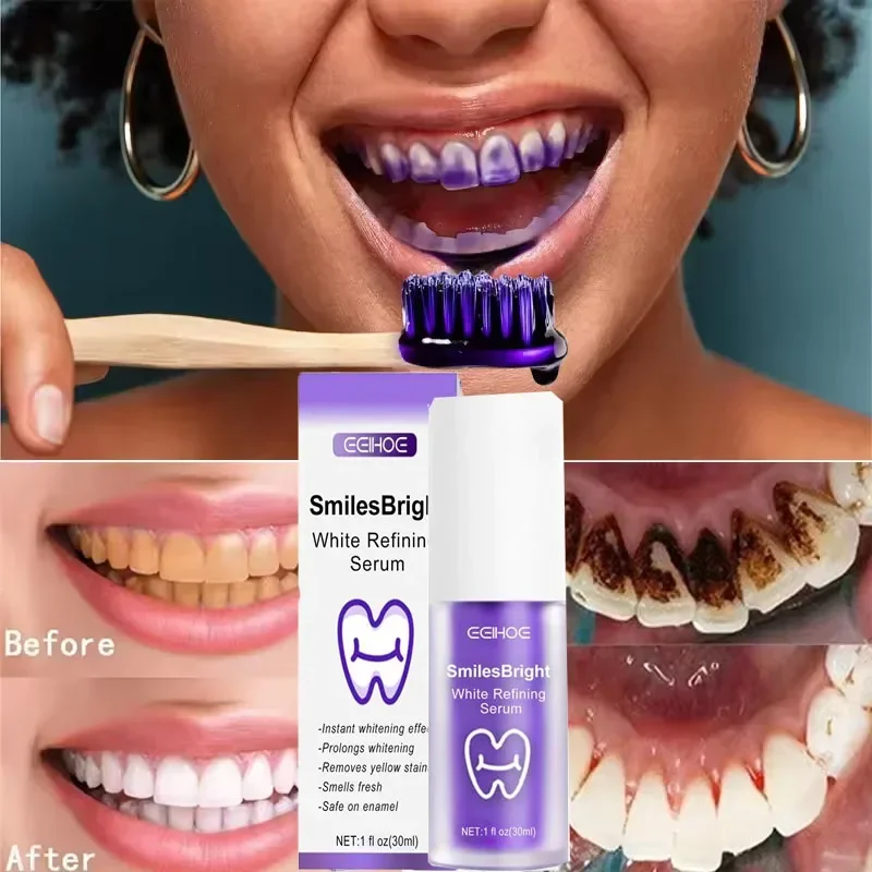 歯のクリーニング ホワイトニング歯磨き粉 ホワイトニングジェ - Teeth Whitening Korea のレビューと価格