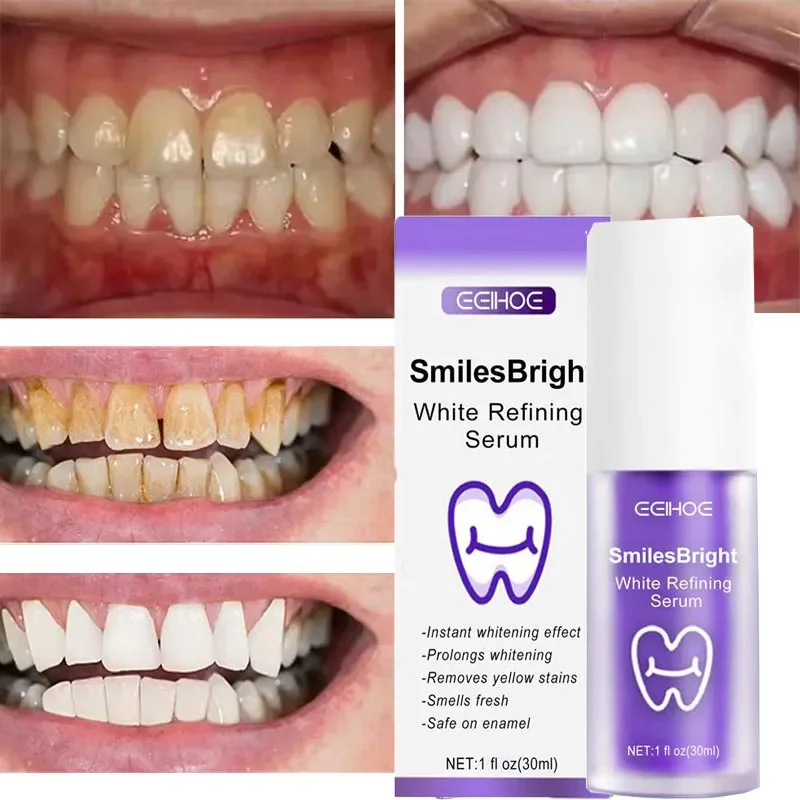 歯のクリーニング ホワイトニング歯磨き粉 ホワイトニングジェ - Teeth Whitening Korea のレビューと価格