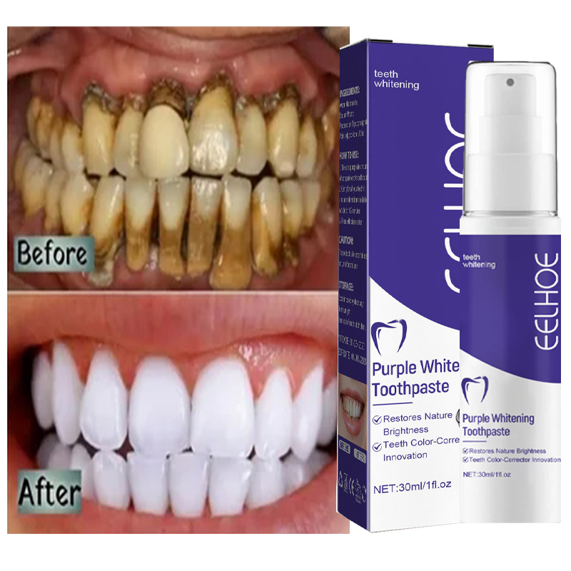 歯のホワイトニングジェルパッチ,ホワイトニング用漂白剤,汚れ - Teeth Whitening Korea のレビューと価格