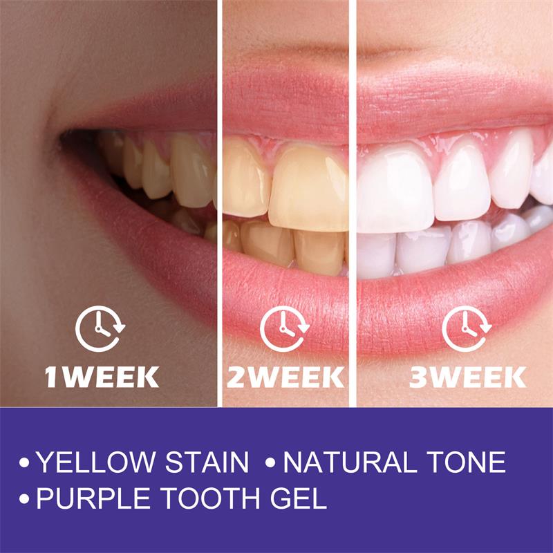 歯のホワイトニングジェルパッチ,ホワイトニング用漂白剤,汚れ - Teeth Whitening Korea のレビューと価格