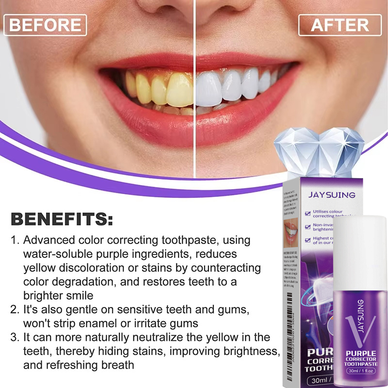 歯のホワイトニング歯磨き粉、ホワイトニングジェル、ホワイトナ - Teeth Whitening Korea のレビューと価格