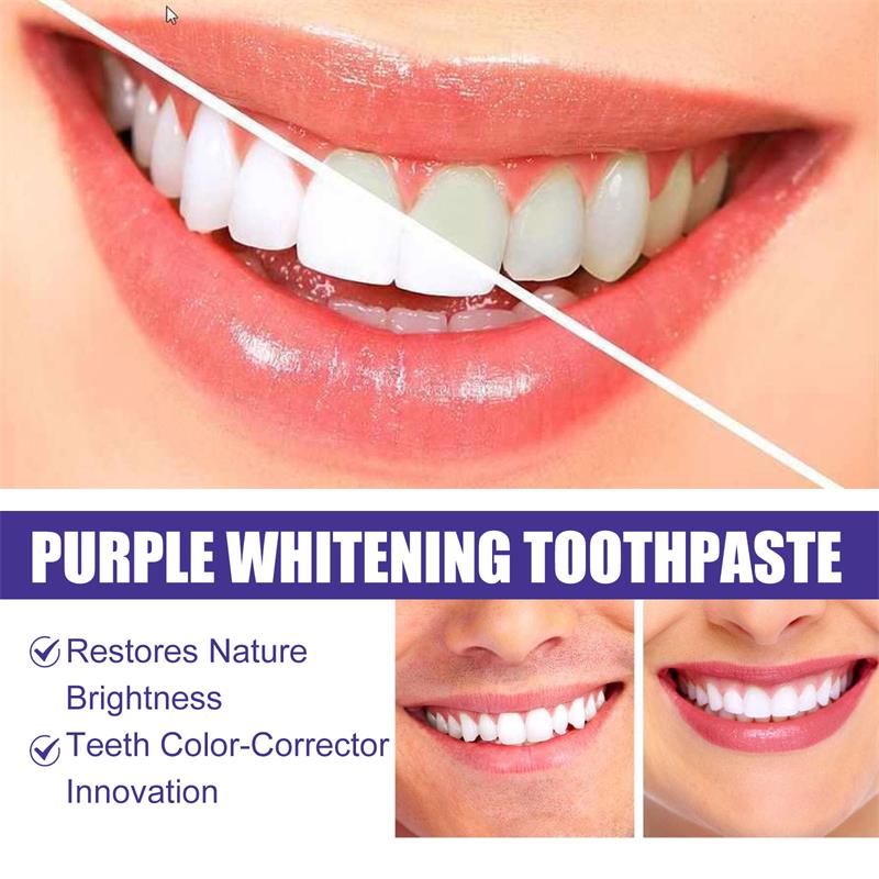 歯のホワイトニング歯磨き粉、ホワイトニングジェル、ホワイトナ - Teeth Whitening Korea のレビューと価格