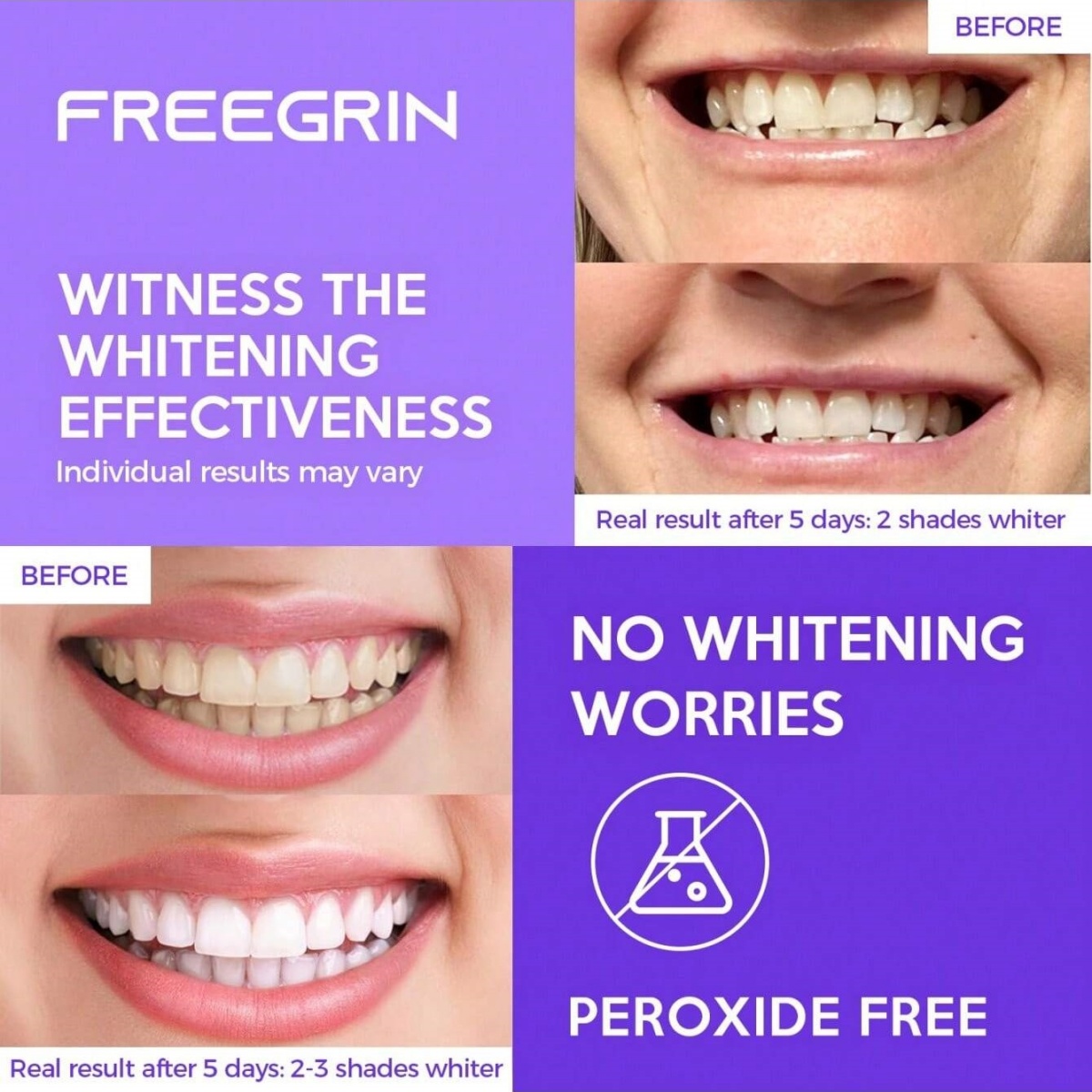 デラックスホワイトニング歯ステッカー 7/14/21 ペアジ - Teeth Whitening With Peroxide のレビューと価格