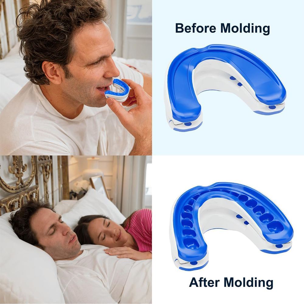 いびき防止マウスピース,いびき防止装置,夜間の歯のガード,歯 - Teeth Whitening Mouth Guard のレビューと価格