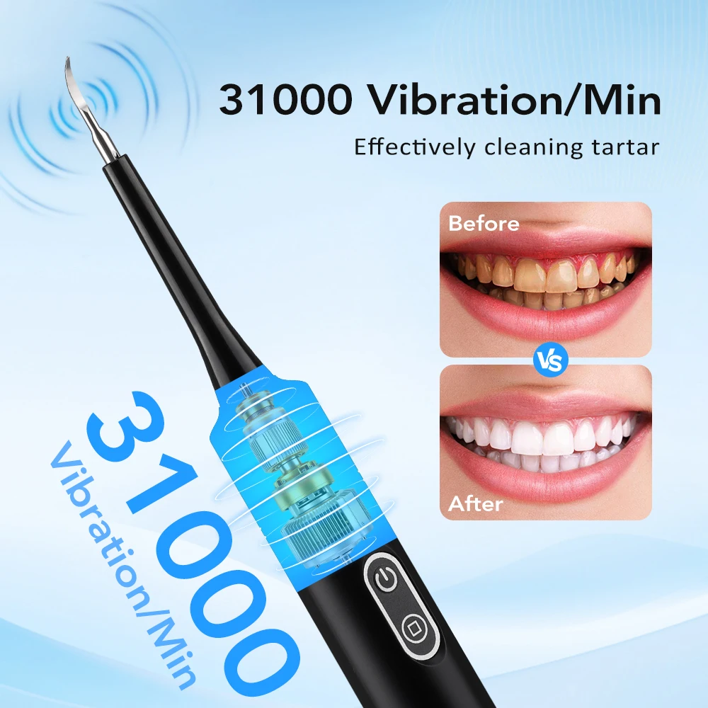 電気音波振動歯科用スケーラー歯のホワイトニング歯垢除去コーヒ - Teeth Whitening Uk のレビューと価格